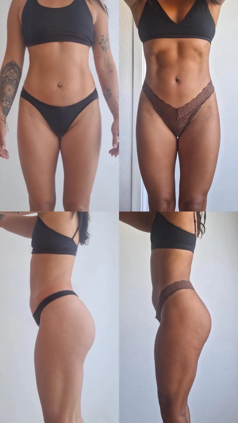 Nathalie, before and after